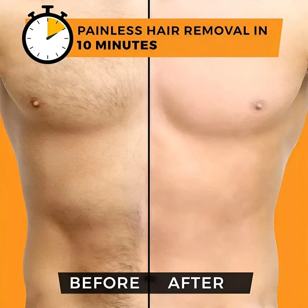 Sydonic Permanent Facial Hair Removal